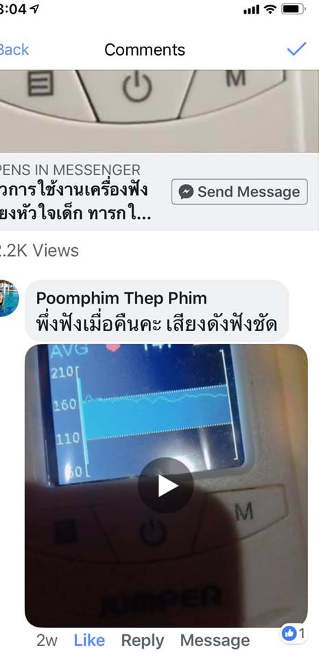 เครื่องฟังเสียงหัวใจทารกในครรภ์ ดิจิตอลใหม่ พร้อมจอมอนิเตอร์สี Jumper Angelsounds รุ่น JPD-100S6+ ราคาพิเศษครบชุด