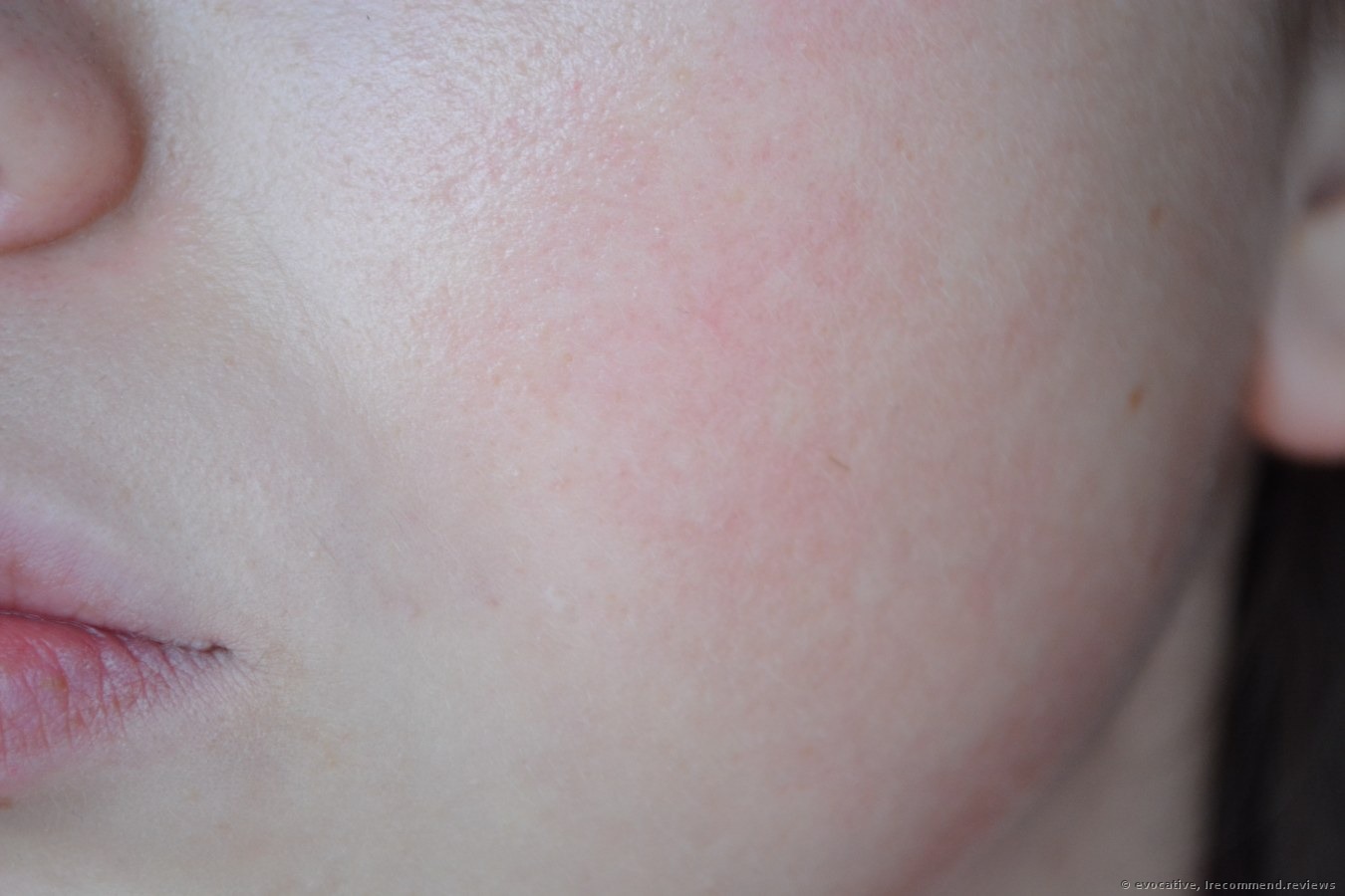 มอยซ์เจอไรเซอร์ Clinique Pep -Start Hydrorush Moisturizer SPF 20 Hydratant Express 50ml