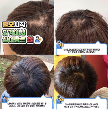 [3 ชิ้นขึ้นไป] สเปรย์ลดผมร่วงผมบาง Terapic Premium Total Hair Tonic 150 ml จากเกาหลี ที่สำคัญเป็น organic ไร้สารเคมี