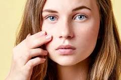 Image result for acne