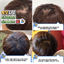 [3 ชิ้นขึ้นไป] สเปรย์ลดผมร่วงผมบาง Terapic Premium Total Hair Tonic 150 ml จากเกาหลี ที่สำคัญเป็น organic ไร้สารเคมี