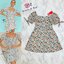 Freepeple Dress เดรสแขนสั้น เนื้อผ้าพิมพ์ลายต้อนรับซัมเมอร์ที่กำลังจะมาถึง